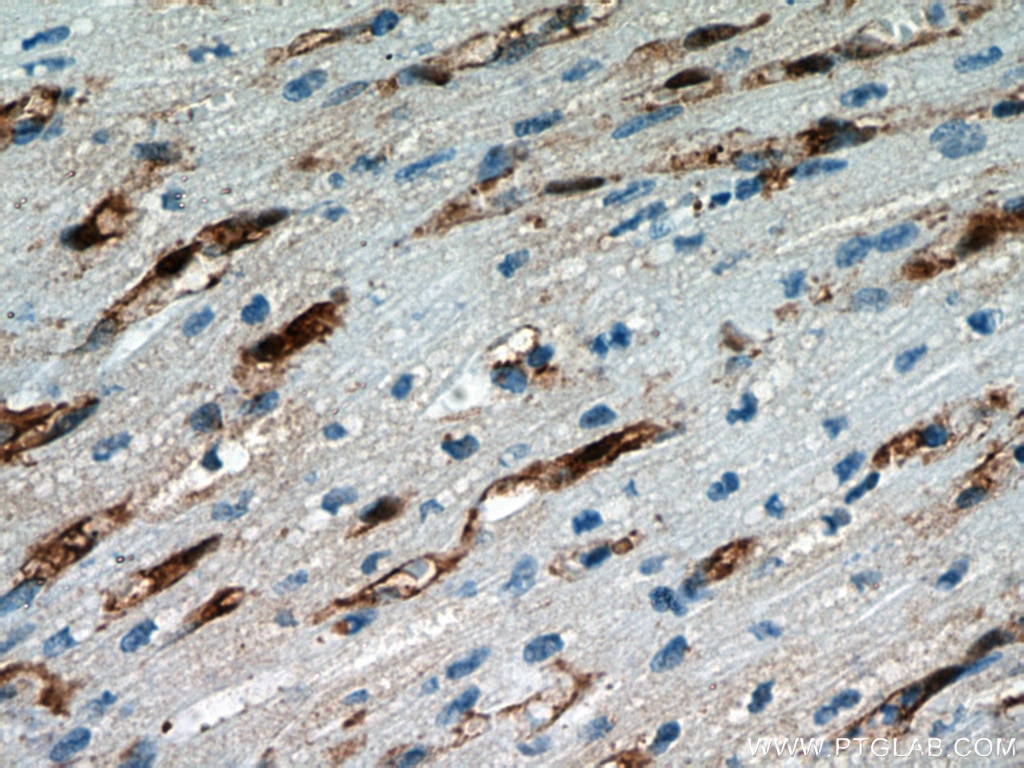 Immunohistochemistry (IHC) staining of human heart tissue using FABP4 Polyclonal antibody (12802-1-AP)