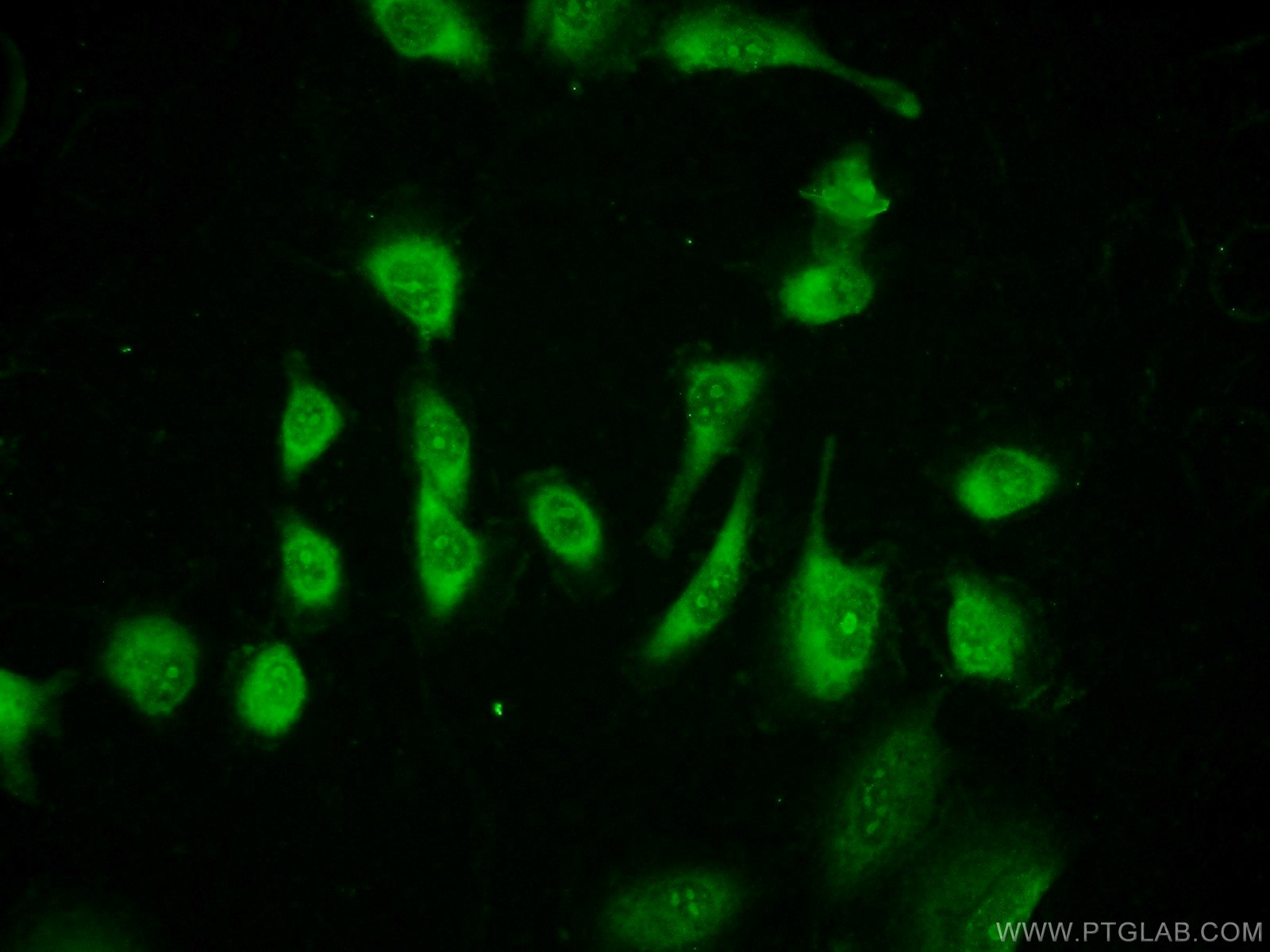 Immunofluorescence (IF) / fluorescent staining of HUVEC cells using FABP4 Polyclonal antibody (15872-1-AP)