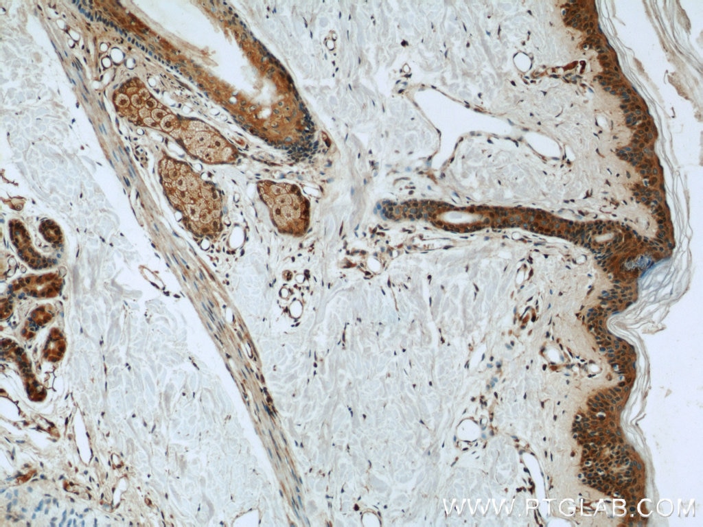 Immunohistochemistry (IHC) staining of human skin tissue using FABP4 Polyclonal antibody (15872-1-AP)