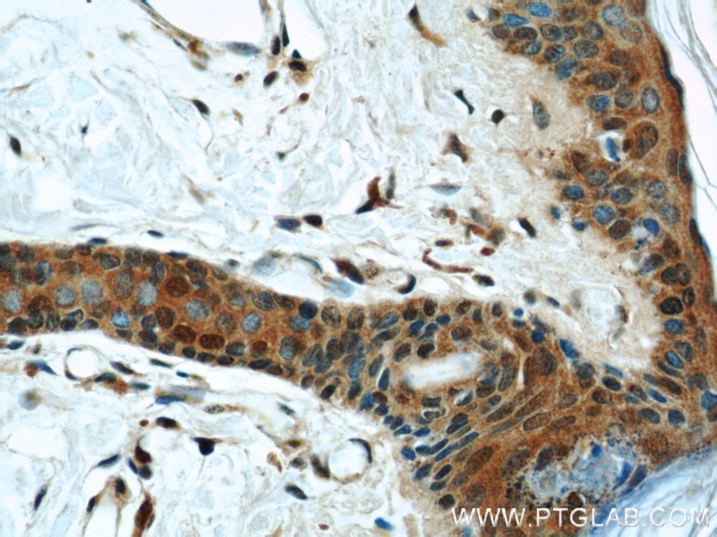 Immunohistochemistry (IHC) staining of human skin tissue using FABP4 Polyclonal antibody (15872-1-AP)