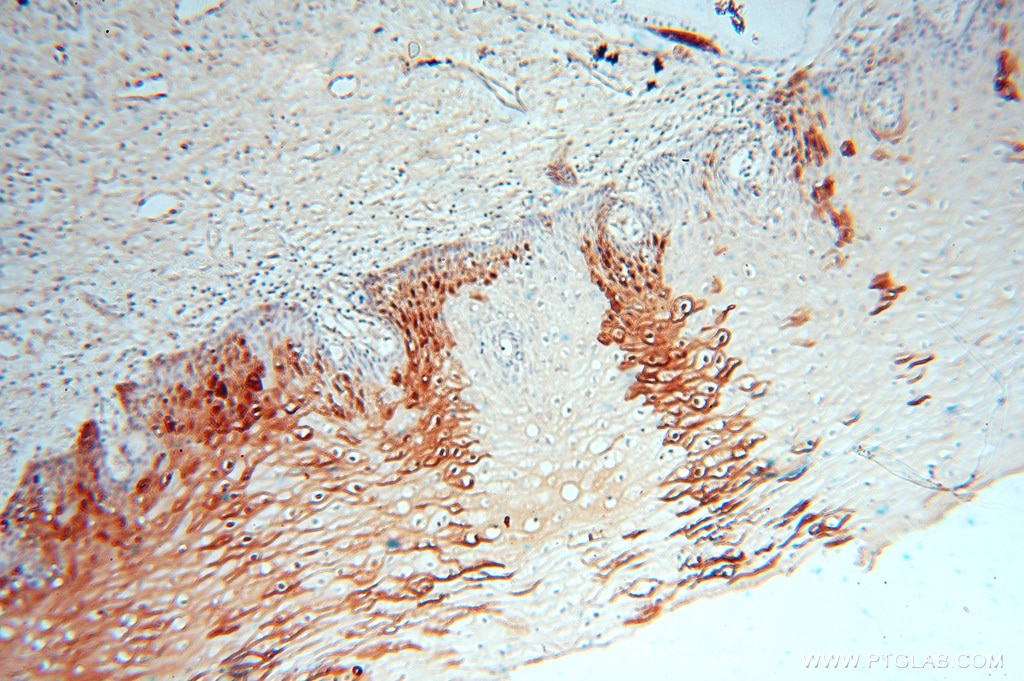 Immunohistochemistry (IHC) staining of human cervix tissue using FABP4 Polyclonal antibody (15872-1-AP)