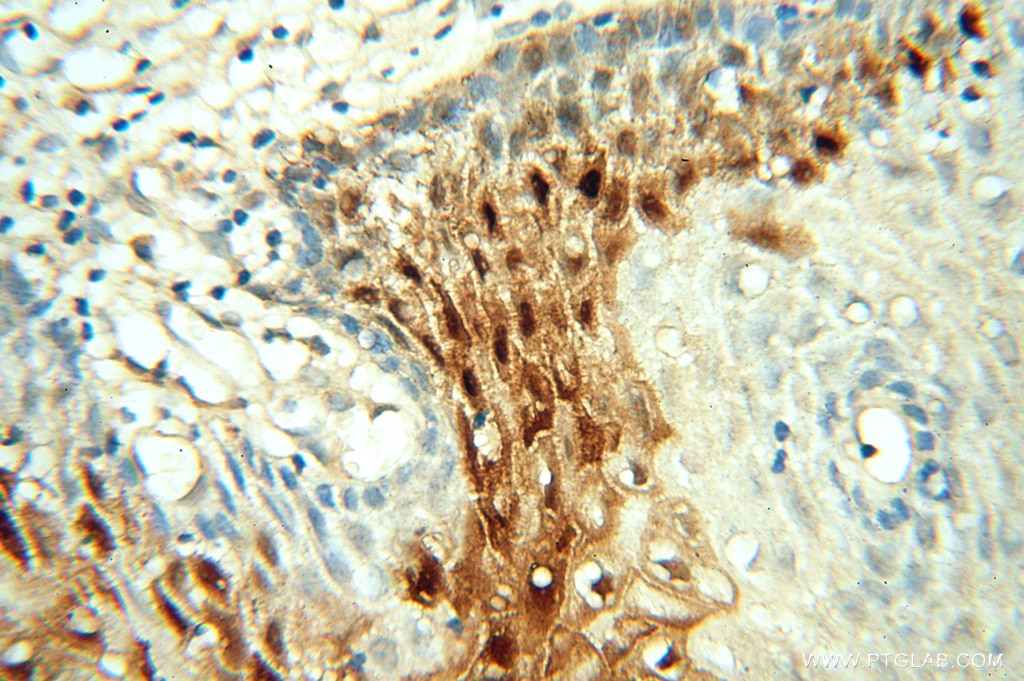 Immunohistochemistry (IHC) staining of human cervix tissue using FABP4 Polyclonal antibody (15872-1-AP)