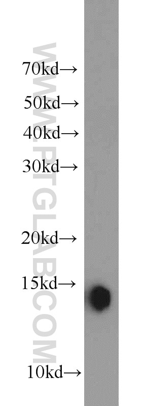 WB analysis of mouse skeletal muscle using 15872-1-AP