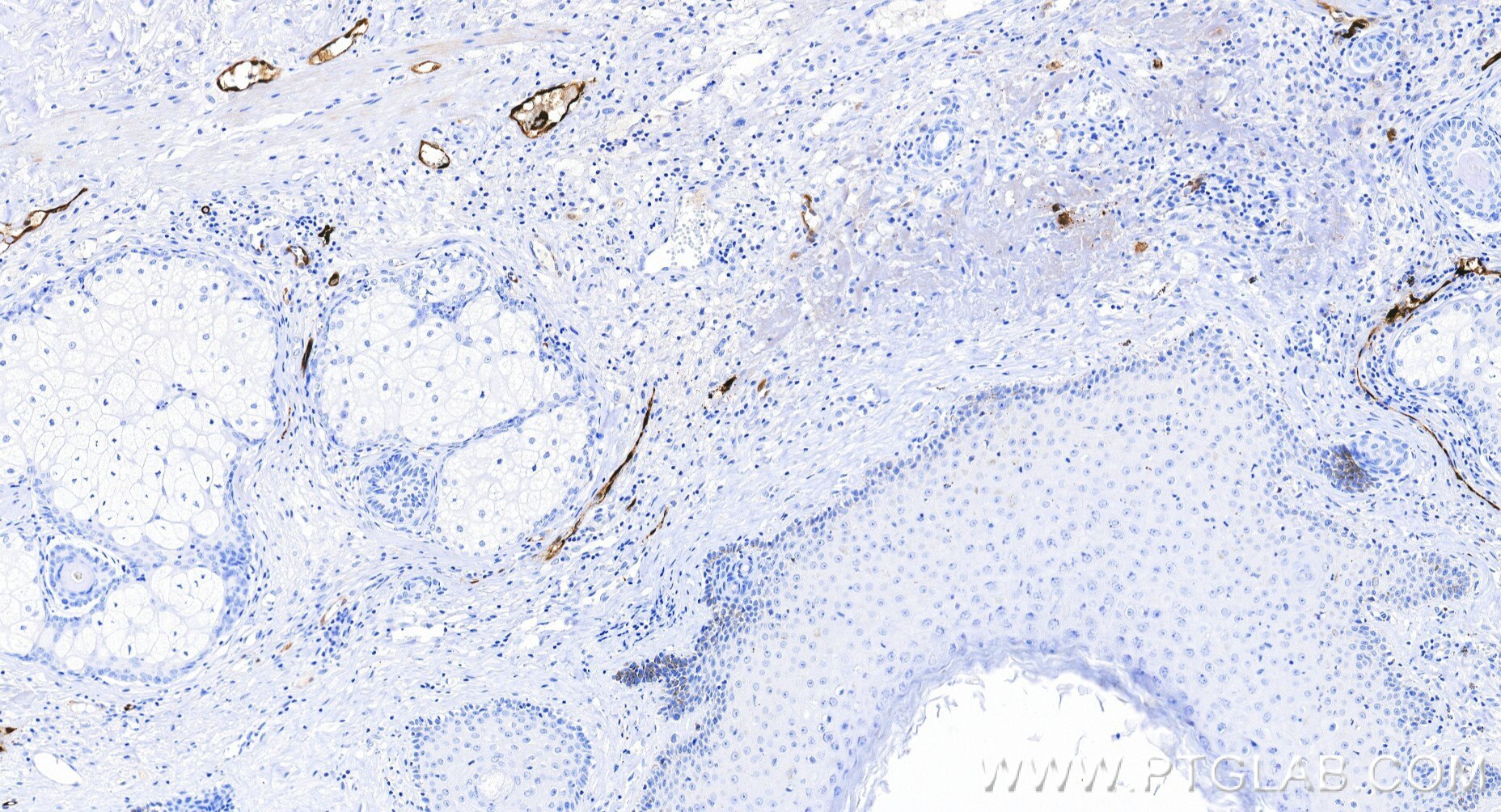 Immunohistochemistry (IHC) staining of human skin tissue using FABP4 Recombinant monoclonal antibody (85864-2-RR)