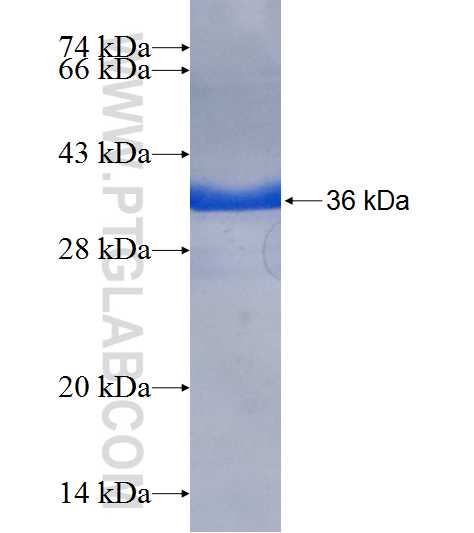 FABP4 fusion protein Ag8631 SDS-PAGE