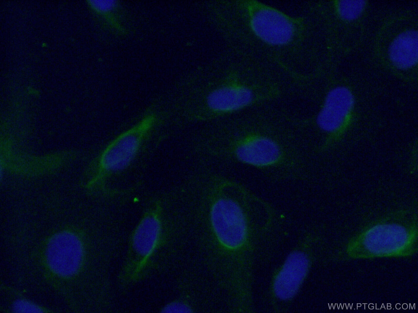 Immunofluorescence (IF) / fluorescent staining of U2OS cells using FABP5 Polyclonal antibody (12348-1-AP)