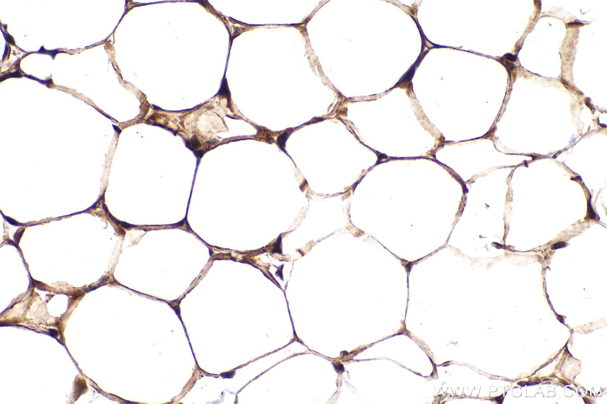IHC staining of mouse brown adipose using 12348-1-AP