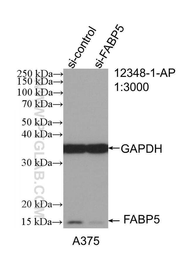 Western Blot (WB) analysis of A375 cells using FABP5 Polyclonal antibody (12348-1-AP)
