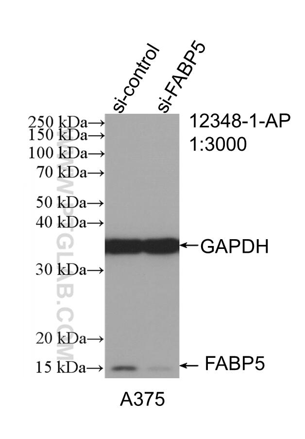 WB analysis of A375 using 12348-1-AP