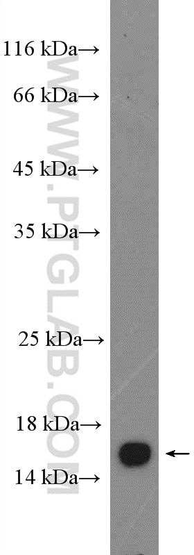 Western Blot (WB) analysis of mouse skin tissue using FABP5 Polyclonal antibody (12348-1-AP)