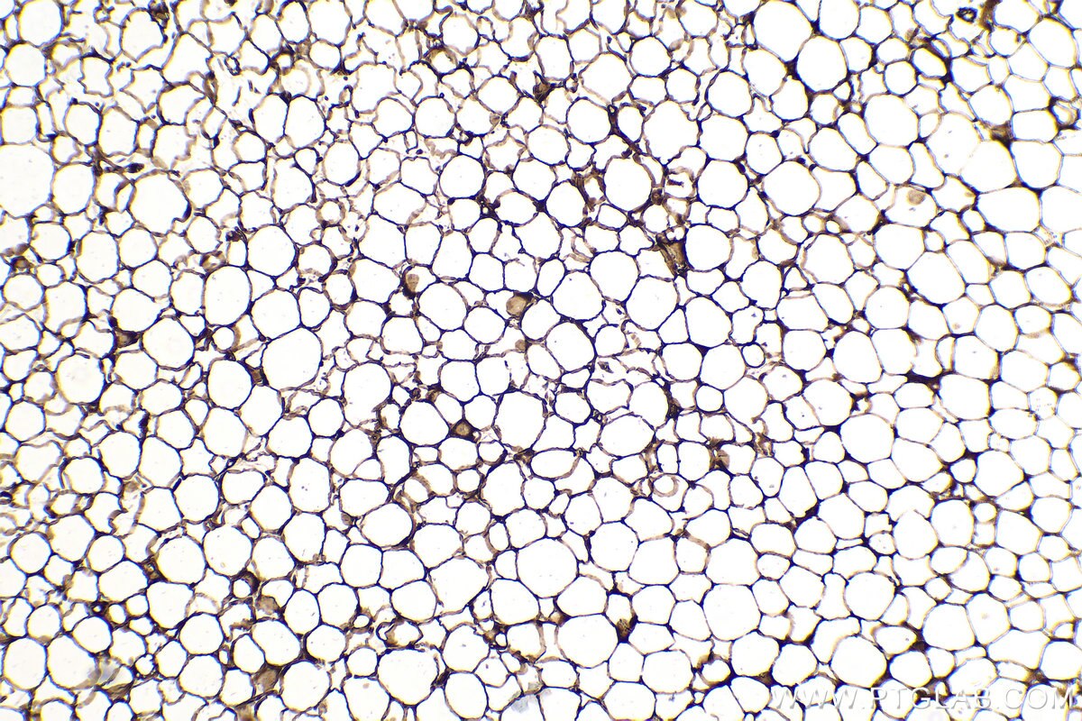 IHC staining of mouse brown adipose using 66299-1-Ig