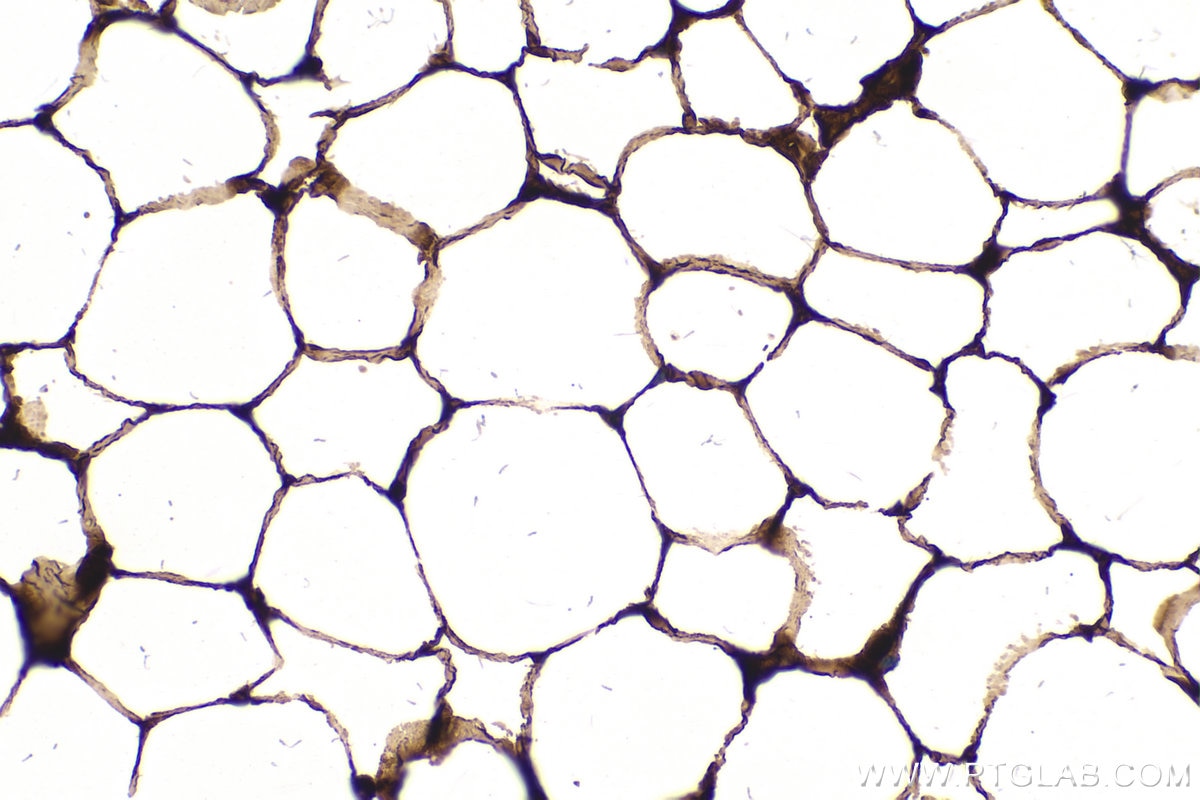 Immunohistochemistry (IHC) staining of mouse brown adipose tissue using FABP5 Monoclonal antibody (66299-1-Ig)