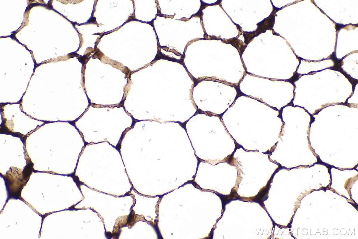 IHC staining of mouse brown adipose using 66299-1-Ig