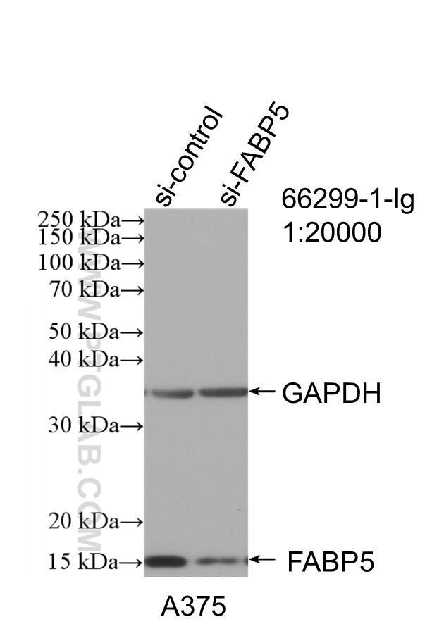 Western Blot (WB) analysis of A375 cells using FABP5 Monoclonal antibody (66299-1-Ig)