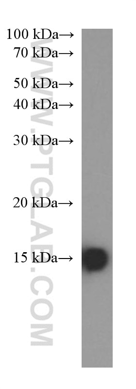 Western Blot (WB) analysis of fetal human brain tissue using FABP5 Monoclonal antibody (66299-1-Ig)