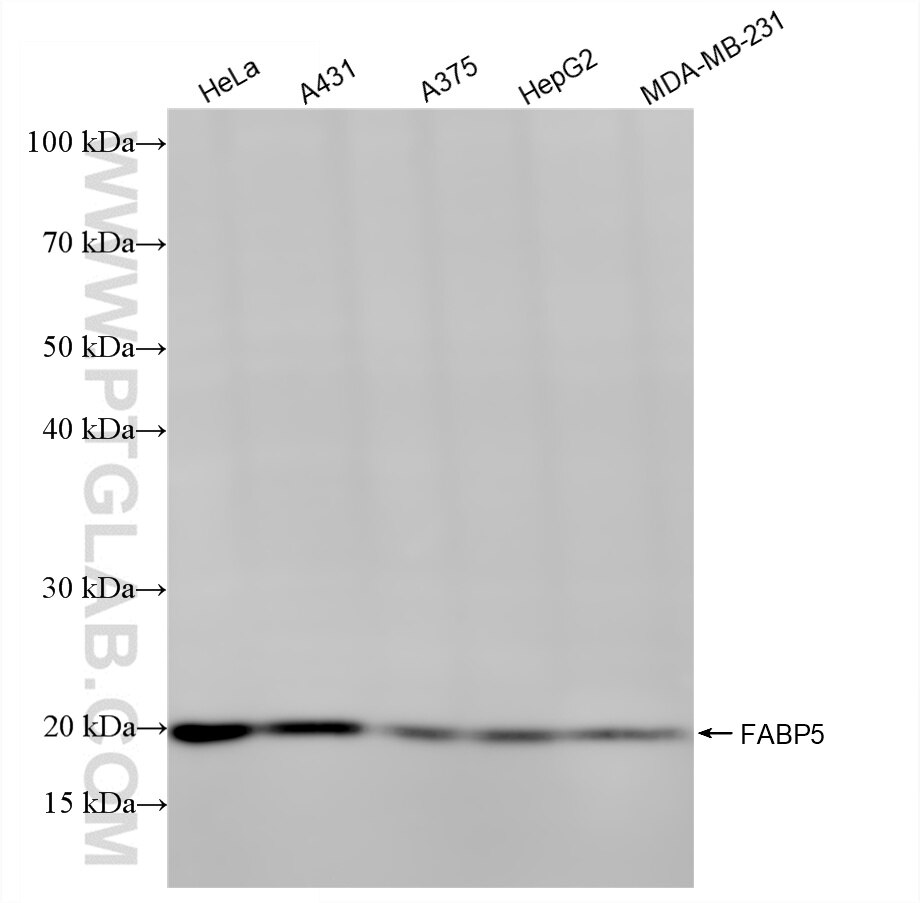 Various lysates were subjected to SDS PAGE followed by western blot with 82551-2-RR (FABP5 antibody) at dilution of 1:10000 incubated at room temperature for 1.5 hours. Western Blot (WB) analysis of various lysates using FABP5 Recombinant antibody (82551-2-RR)