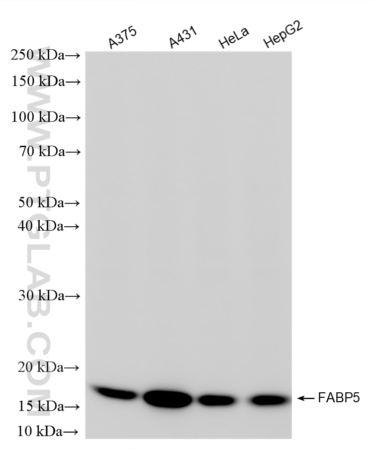 Various lysates were subjected to SDS PAGE followed by western blot with 82551-2-RR (FABP5 antibody) at dilution of 1:8000 incubated at room temperature for 1.5 hours. Western Blot (WB) analysis of various lysates using FABP5 Recombinant monoclonal antibody (82551-2-RR)