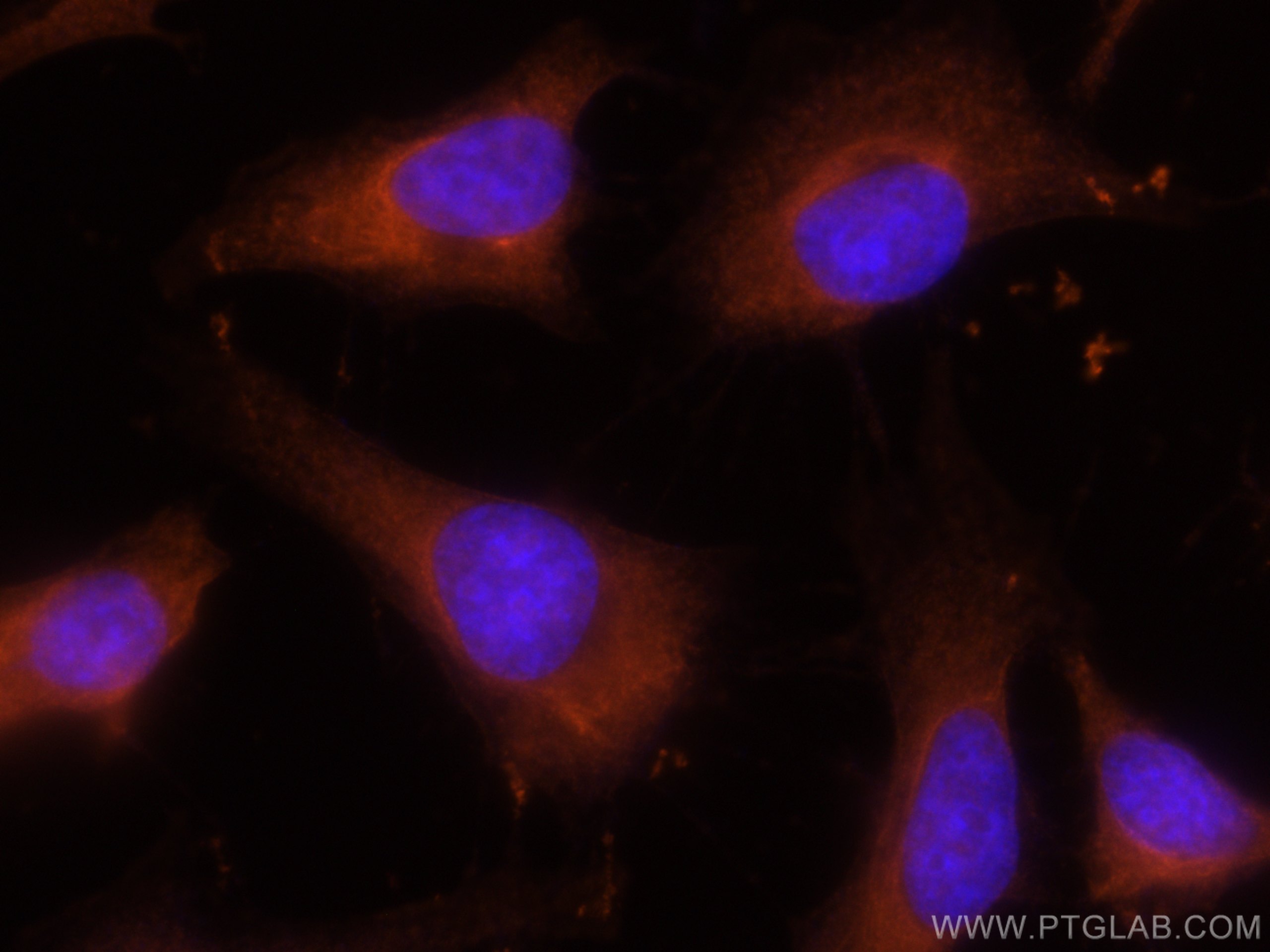 Immunofluorescence (IF) / fluorescent staining of HeLa cells using CoraLite®555-conjugated FABP5 Polyclonal antibody (CL555-12348)