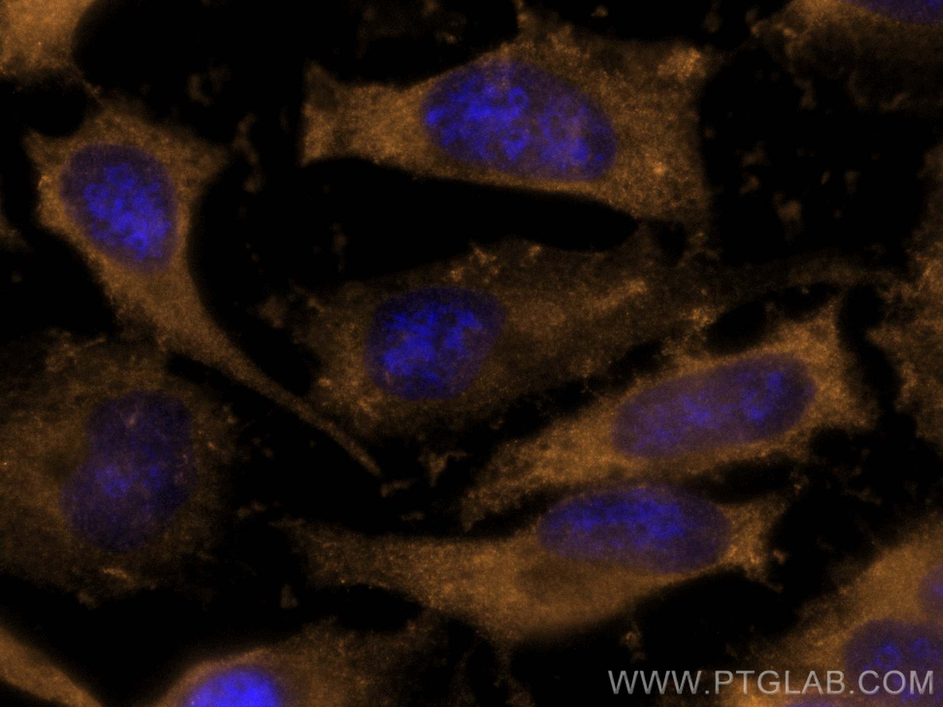 IF Staining of HeLa using CL555-12348