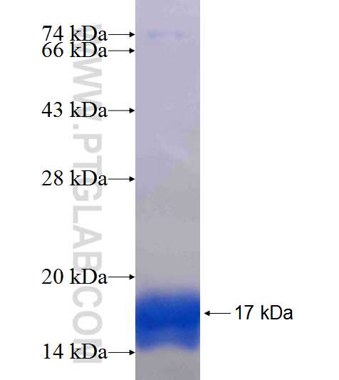 FABP5 fusion protein Ag18774 SDS-PAGE