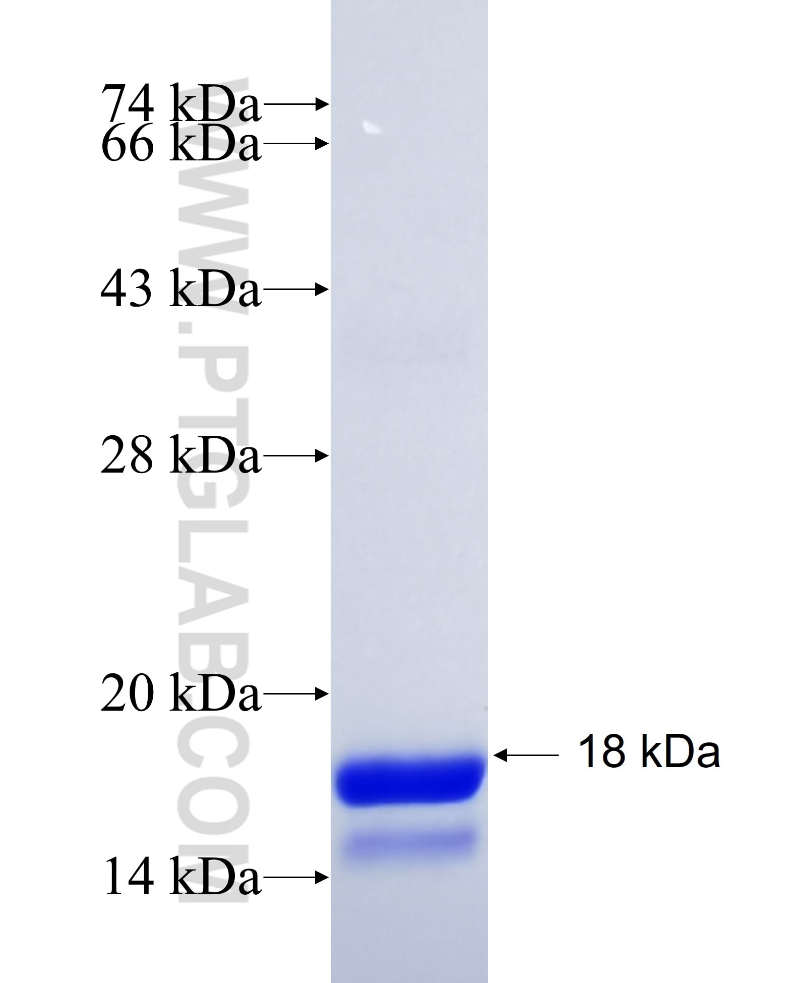 FABP5 fusion protein Ag18774 SDS-PAGE