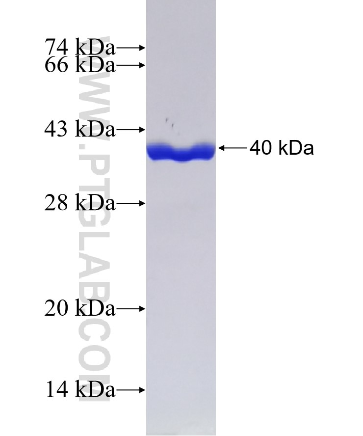 FABP5 fusion protein Ag3005 SDS-PAGE