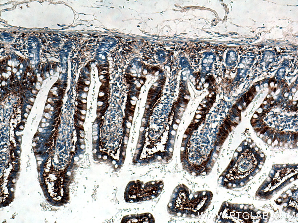 Immunohistochemistry (IHC) staining of human small intestine tissue using FABP6 Polyclonal antibody (13781-1-AP)