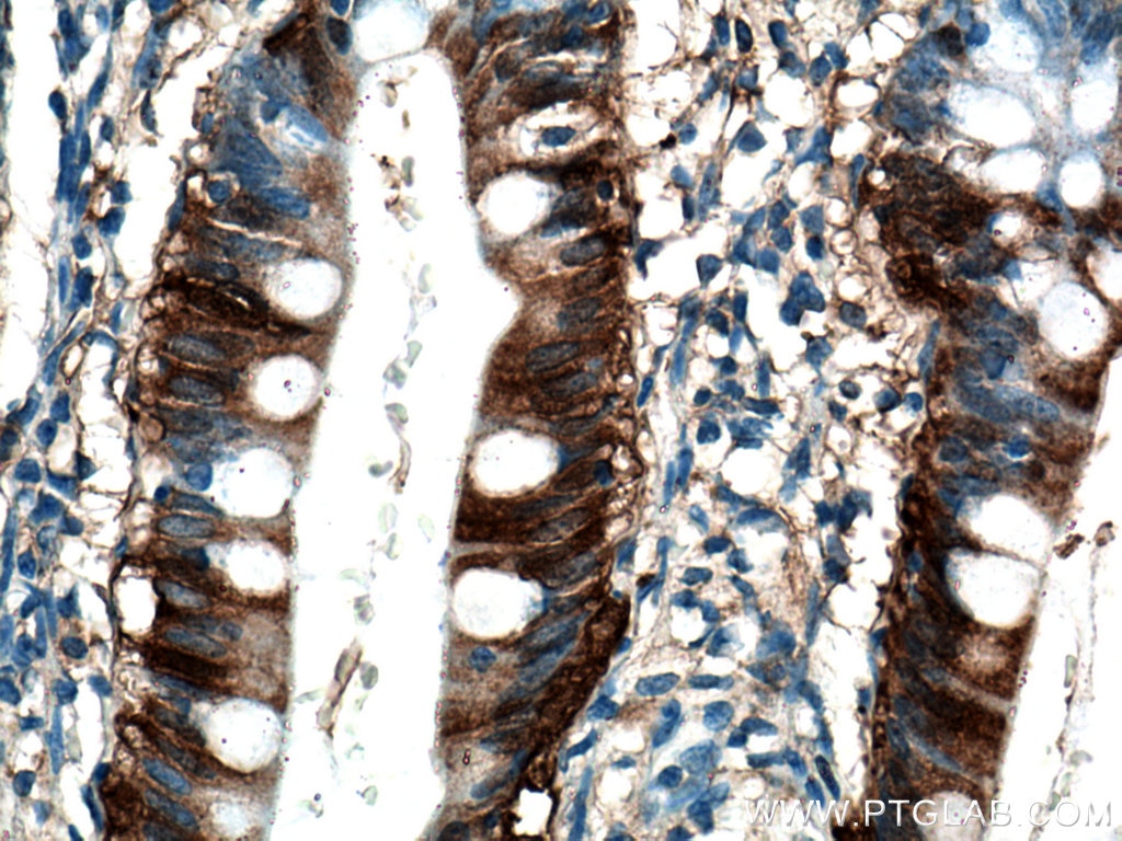 Immunohistochemistry (IHC) staining of human small intestine tissue using FABP6 Polyclonal antibody (13781-1-AP)