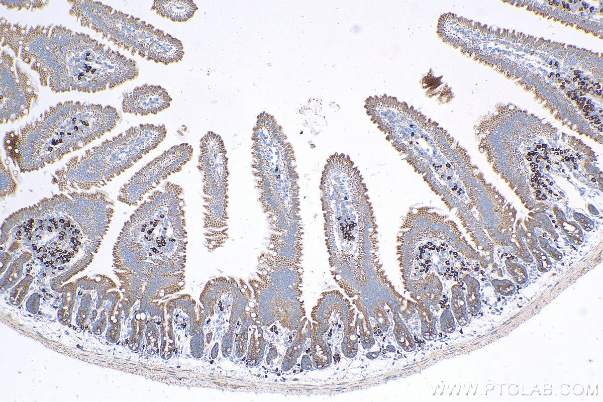 Immunohistochemistry (IHC) staining of mouse small intestine tissue using FABP6 Polyclonal antibody (13781-1-AP)