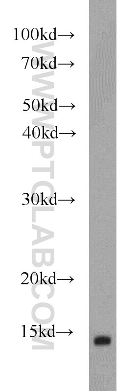 Western Blot (WB) analysis of human brain tissue using FABP7 Polyclonal antibody (17456-1-AP)