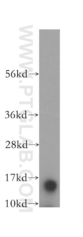 Western Blot (WB) analysis of human brain tissue using FABP7 Polyclonal antibody (17456-1-AP)