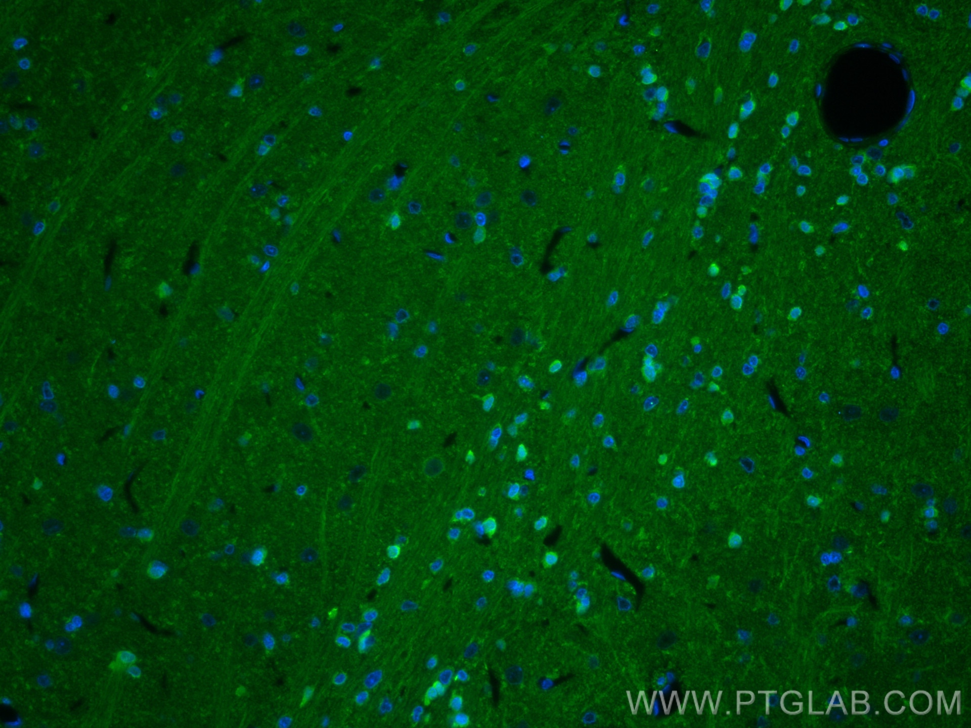 Immunofluorescence (IF) / fluorescent staining of rat brain tissue using FABP7 Polyclonal antibody (51010-1-AP)