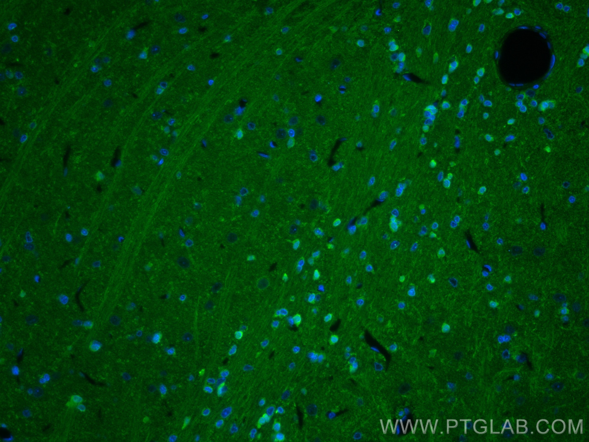 IF Staining of rat brain using 51010-1-AP