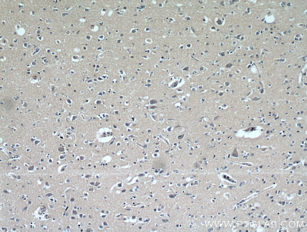 IHC staining of human brain using 51010-1-AP