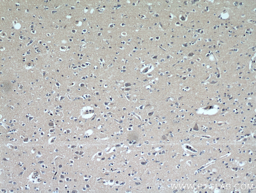 Immunohistochemistry (IHC) staining of human brain tissue using FABP7 Polyclonal antibody (51010-1-AP)