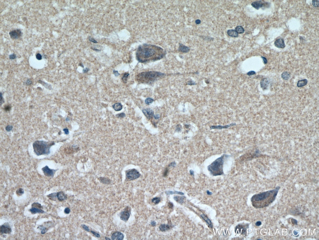 Immunohistochemistry (IHC) staining of human brain tissue using FABP7 Polyclonal antibody (51010-1-AP)
