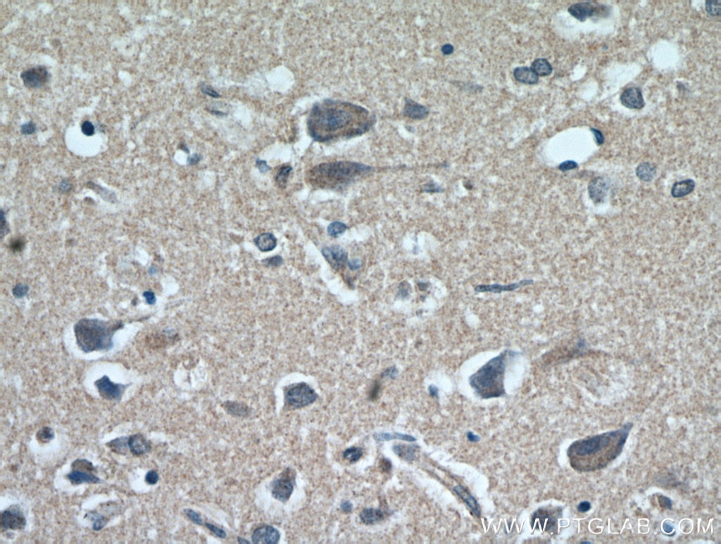 IHC staining of human brain using 51010-1-AP