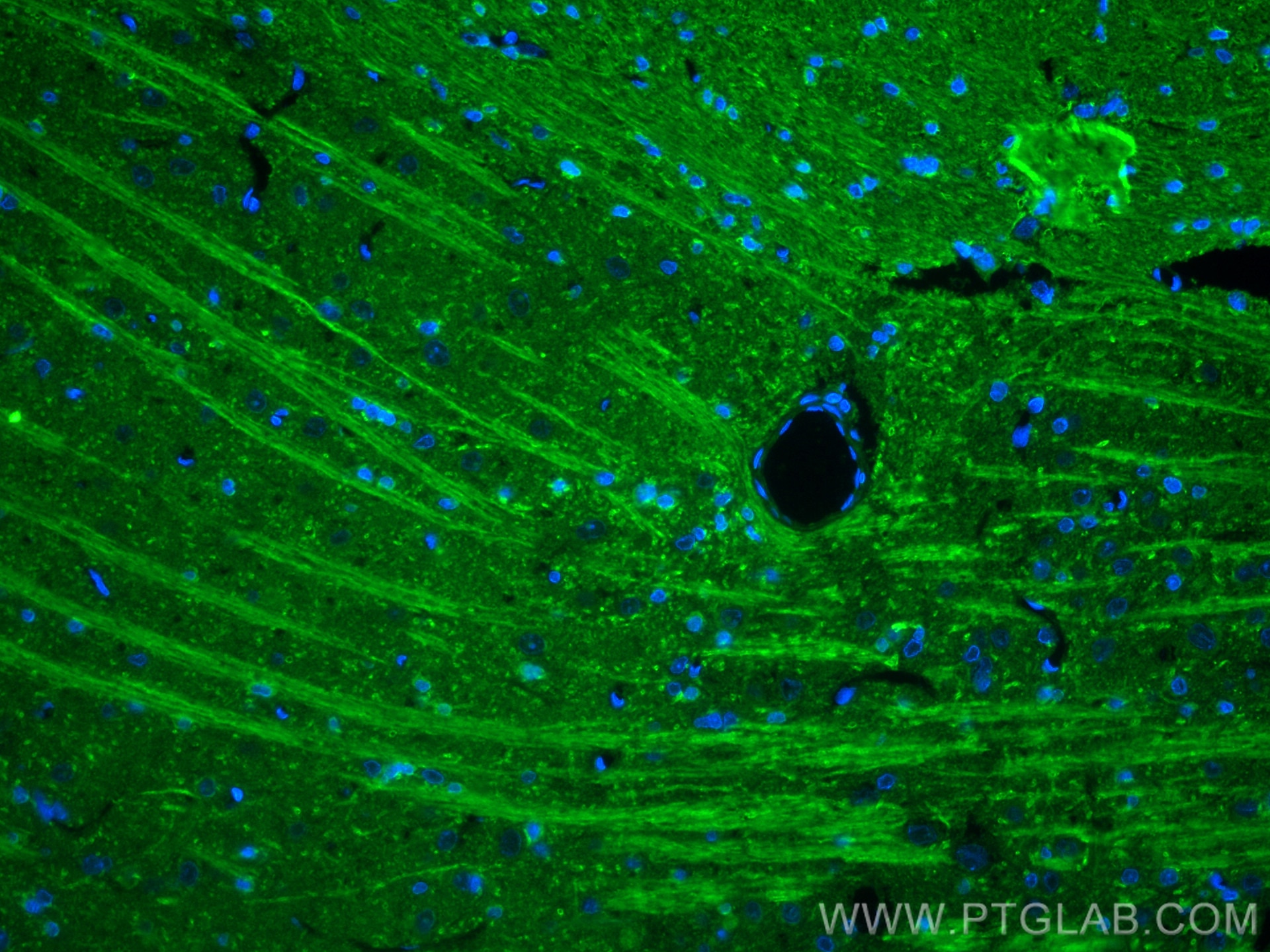 Immunofluorescence (IF) / fluorescent staining of rat brain tissue using FABP7-Specific Polyclonal antibody (14836-1-AP)