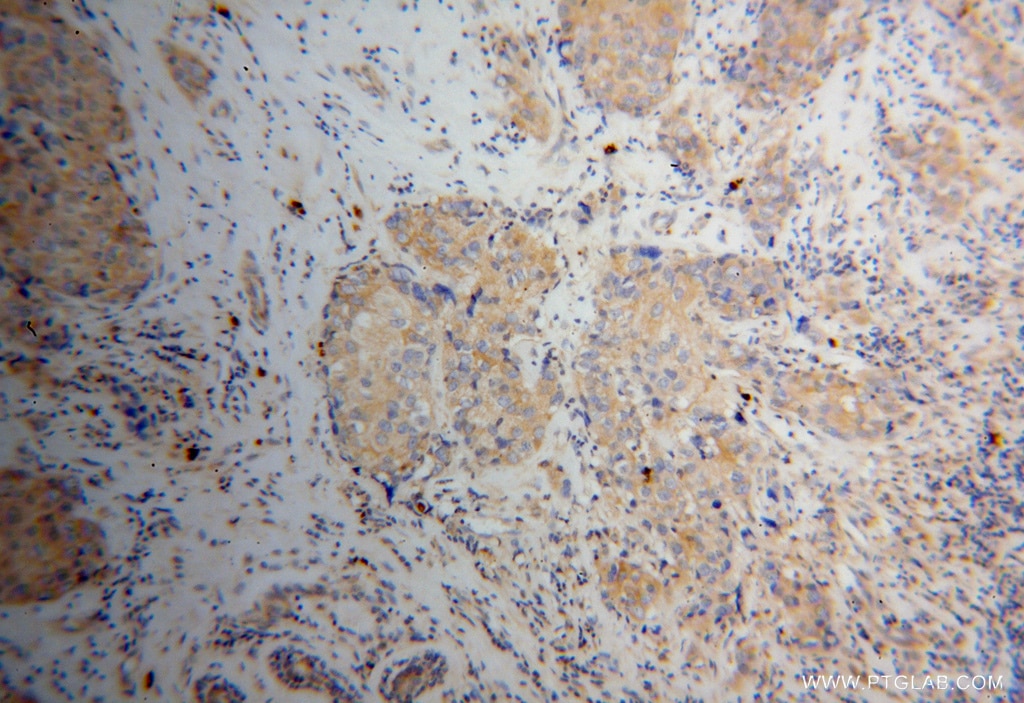 FABP7-Specific Polyclonal antibody