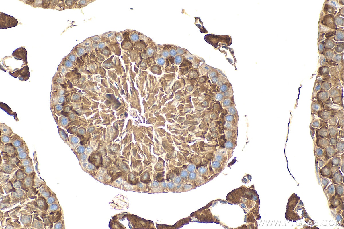 Immunohistochemistry (IHC) staining of mouse testis tissue using FABP9 Polyclonal antibody (31896-1-AP)