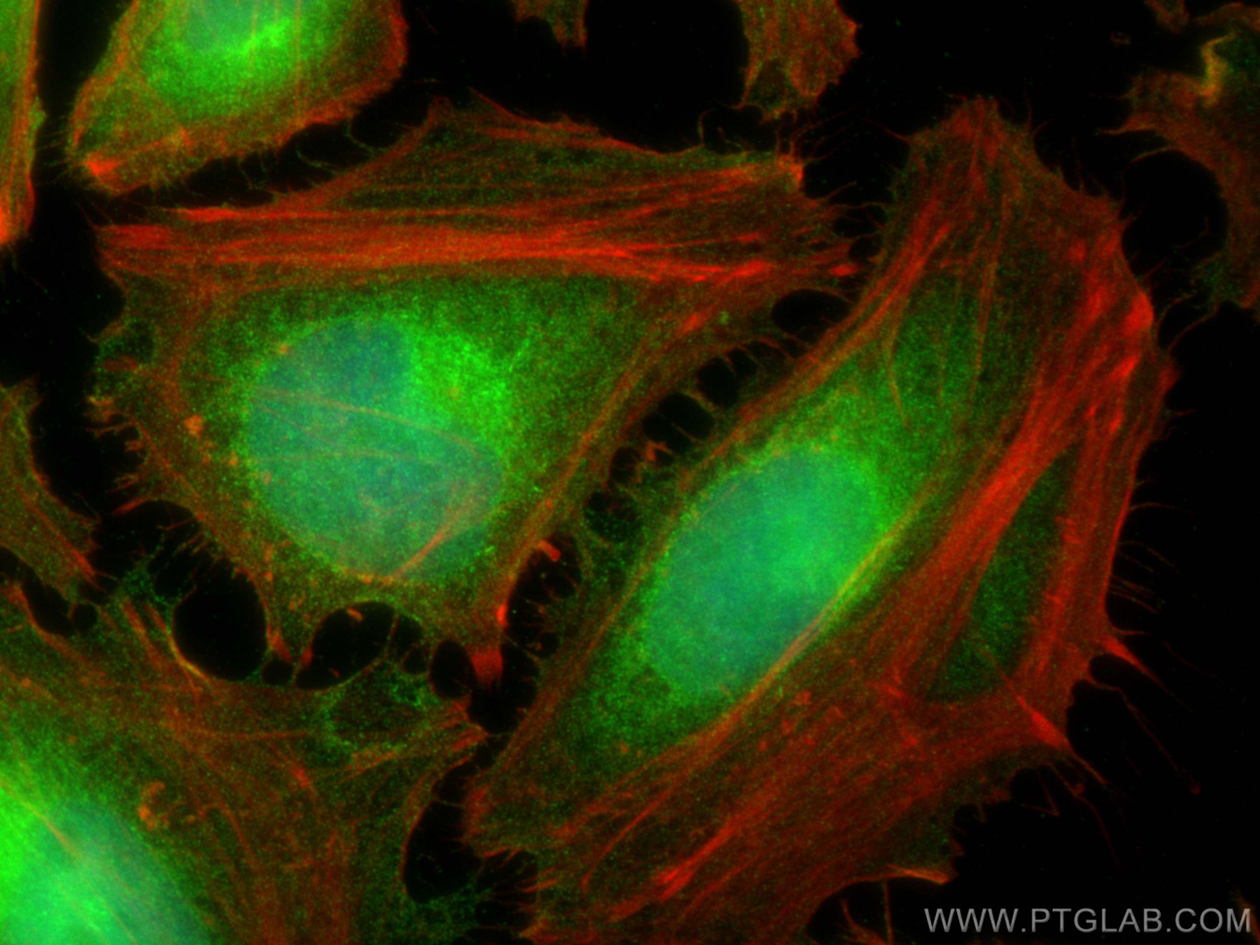 Immunofluorescence (IF) / fluorescent staining of HeLa cells using FADD Polyclonal antibody (14906-1-AP)