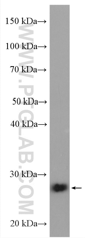 Western Blot (WB) analysis of A549 cells using FADD Polyclonal antibody (14906-1-AP)