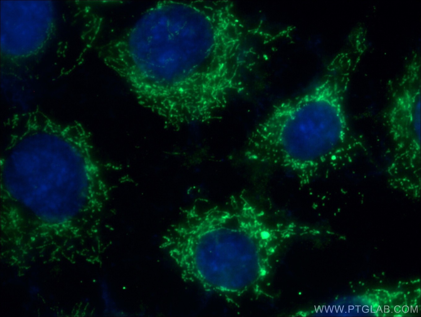 Immunofluorescence (IF) / fluorescent staining of SH-SY5Y cells using FADS1 Polyclonal antibody (10627-1-AP)