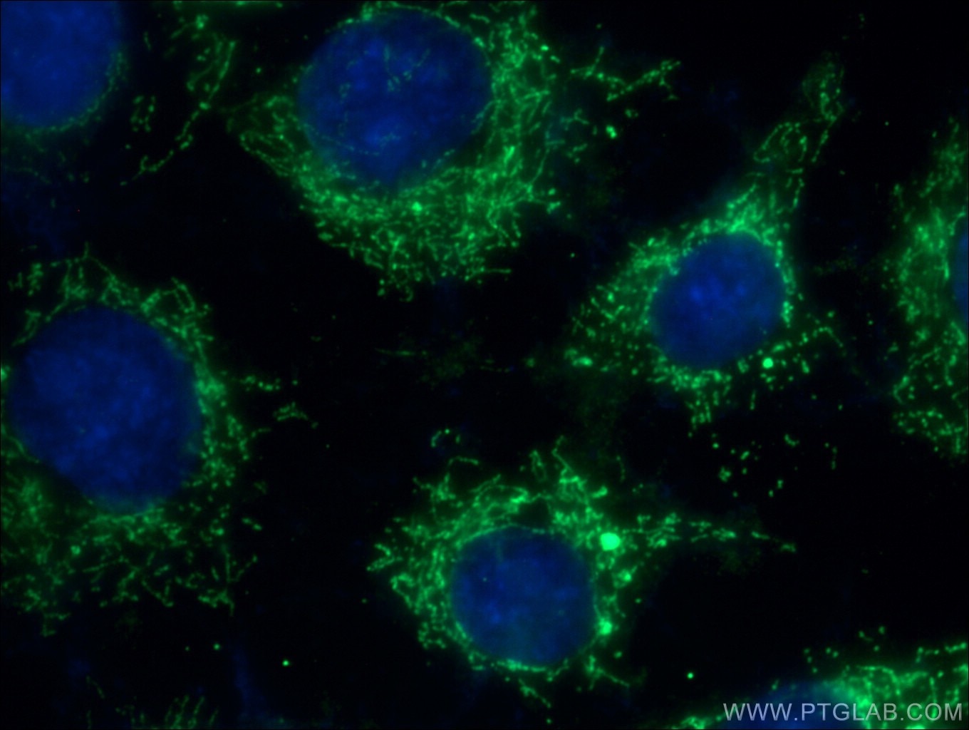 IF Staining of SH-SY5Y using 10627-1-AP