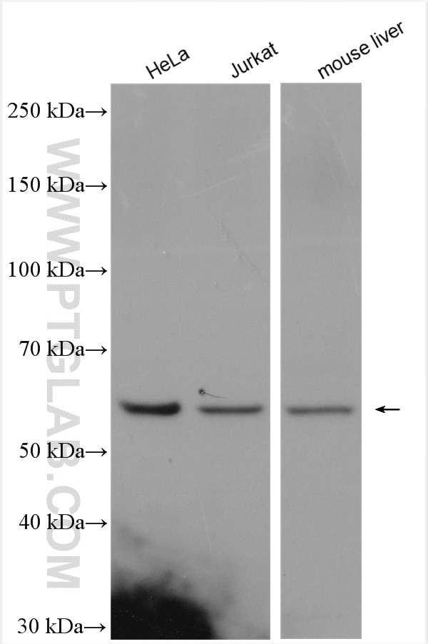 Western Blot (WB) analysis of various lysates using FADS1 Polyclonal antibody (10627-1-AP)