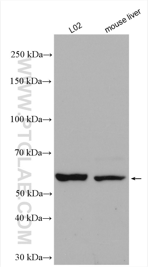 Western Blot (WB) analysis of various lysates using FADS1 Polyclonal antibody (10627-1-AP)