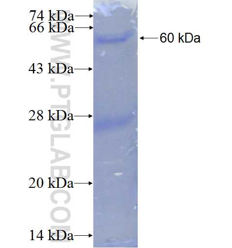FADS1 fusion protein Ag0978 SDS-PAGE