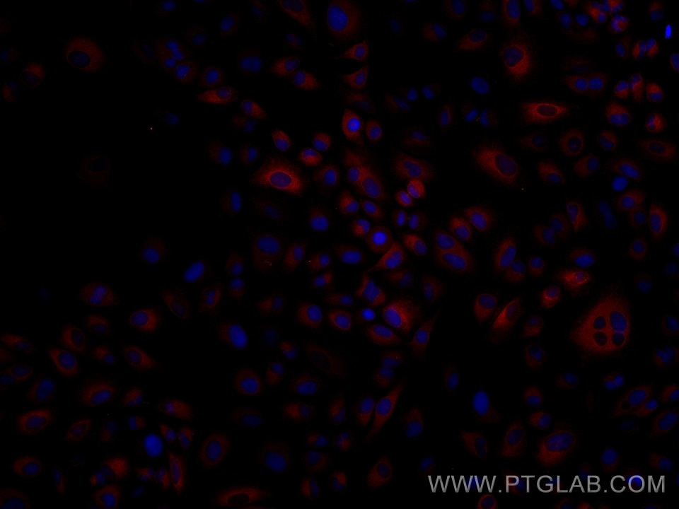 Immunofluorescence (IF) / fluorescent staining of A549 cells using FADS2 Monoclonal antibody (68026-1-Ig)