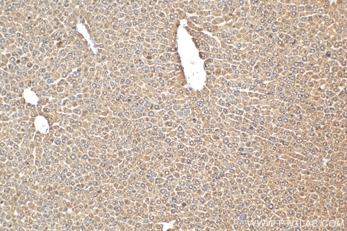 IHC staining of mouse liver using 68026-1-Ig