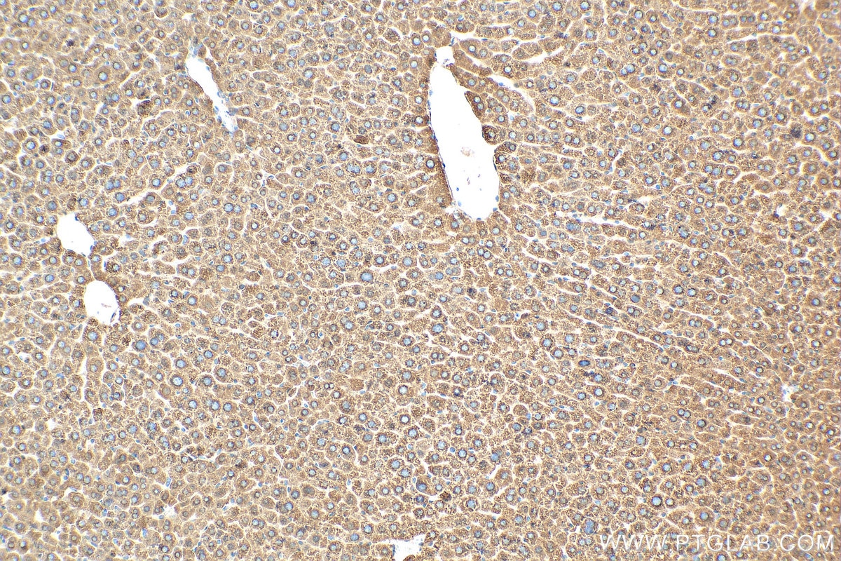 Immunohistochemistry (IHC) staining of mouse liver tissue using FADS2 Monoclonal antibody (68026-1-Ig)